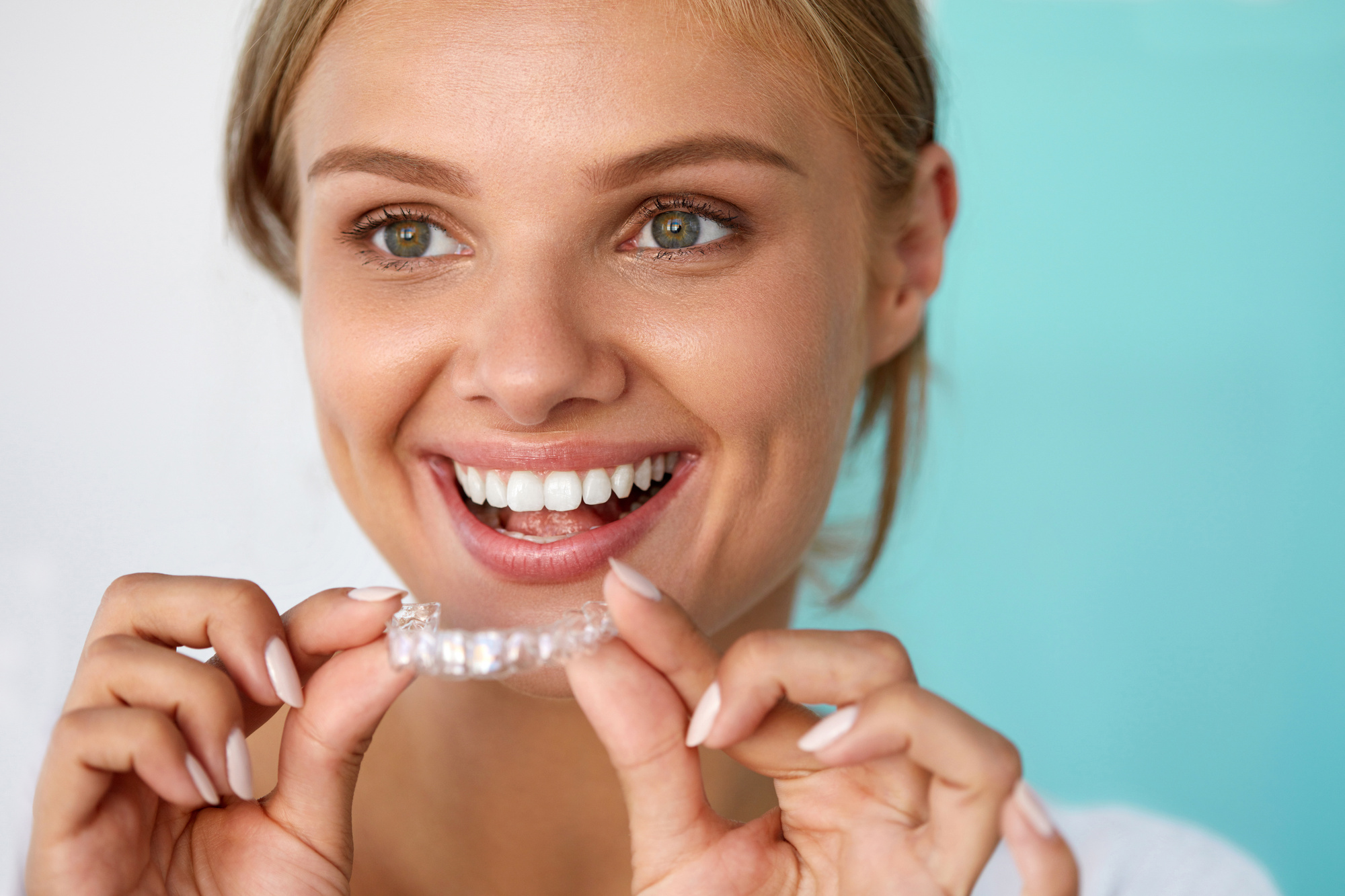 Invisalign & Teeth Aligners Treatment in Lucknow