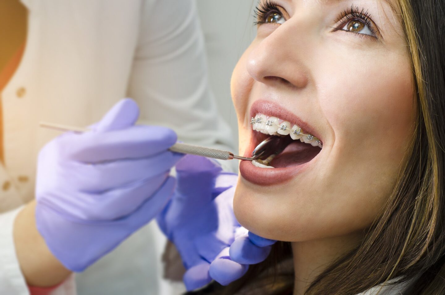 Pros and Cons of Adult Braces: What to Consider Before Treatment